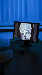 X-ray of the head. X-ray close-up. High-quality photo.