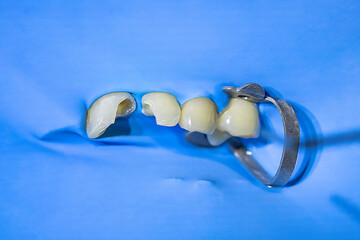 Macro view of a tooth isolated with rubber dam during root canal procedure. Detailed shot of dental...