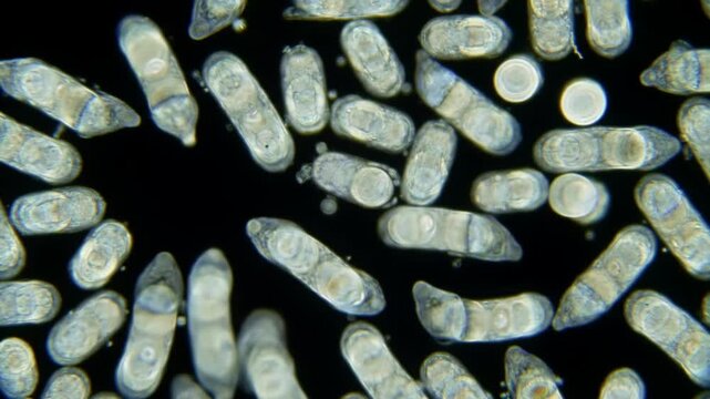 Detailed microscopic visualization of a bacterial colony, showcasing numerous elongated bacilli with internal structures visible against a dark background.