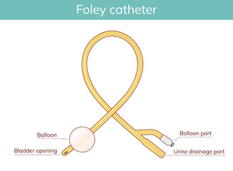 Medical Foley catheter. Hand drawn vector illustration.