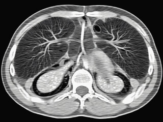 Monochrome X-Ray Style Illustration of Human Liver and Gallbladder Anatomy”