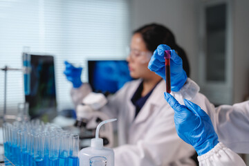 Scientists analyzing blood sample in modern laboratory