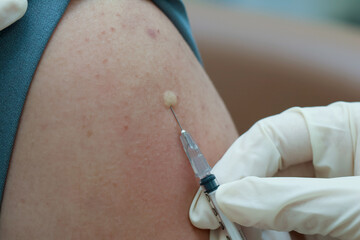 Injection vaccine syringe needle skin medicine healthcare immunization treatment medical procedure...