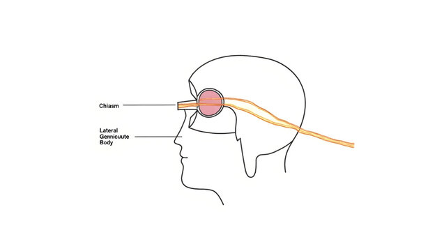 Anatomy & Physiology A labeled diagram of the optic pathway, isolated on white, showing optic nerve, chiasm, tract, lateral geniculate body, and visual cortex for  (3)