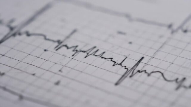 Closeup of Seismograph Measuring Earthquake Activity with Moving Needle and Graph Lines