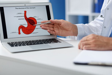 Gastroenterologist showing screen with illustration of stomach at white table in clinic, closeup