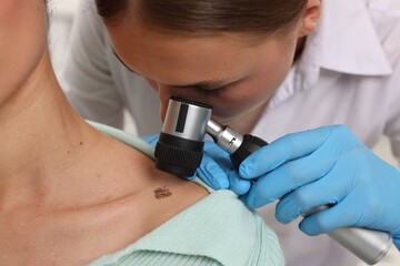 Doctor examining young woman's mole with dermatoscope in hospital, closeup