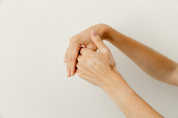 Close-up of a female hand with pale patches of aging reaching in an elegant gesture on a white...