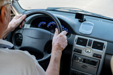 An elderly man is driving a car, holding the steering wheel with both hands, and has vitiligo on...