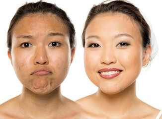 Studio shot of Asian woman showing facial expression before and after makeup makeover on white...