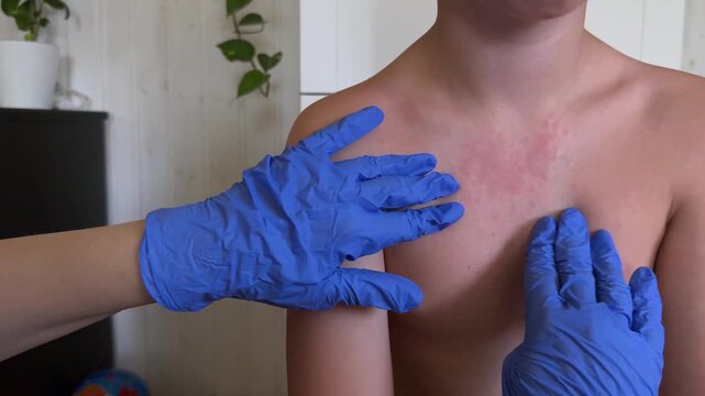 The physician is inspecting the child's skin for signs of monkeypox.