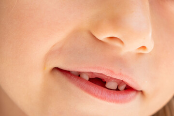 Little girl showing missing tooth, smiling child with long blonde hair, baby tooth fell out,...