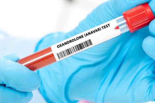 Oxandrolone (Anavar) Test