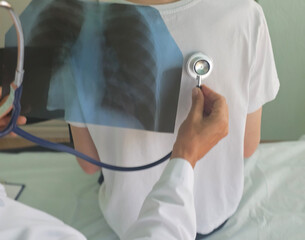 Doctor examining patient with stethoscope while reviewing chest X-ray