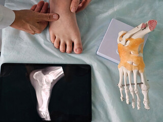 Doctor examining foot with X-ray and skeletal model during consultation
