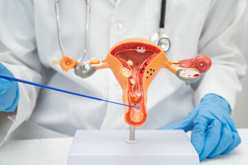 Doctor holding human uterus model for vaginal and cervix pap smear check up in the obstetrics and...