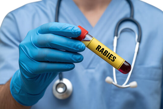 Doctor Holding Blood Sample Tube for Rabies Test in Laboratory