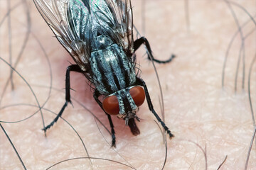 Fly on top of a human leg. Macro photography.
