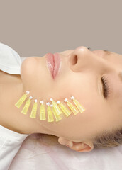  thread-lift procedure for facial rejuvenation