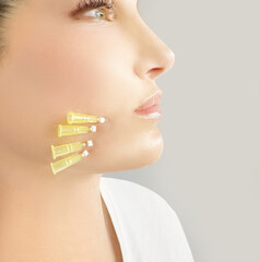  thread-lift procedure for facial rejuvenation