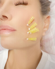  thread-lift procedure for facial rejuvenation