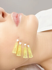  thread-lift procedure for facial rejuvenation