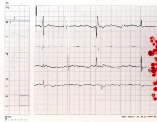 Medical ECG with red spots