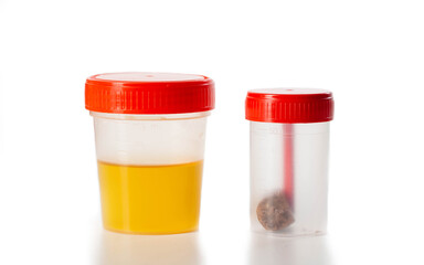 Urine and feces analysis on a white background, isolate. Examination of urine and feces for...