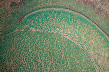 Microscopic cross-section of plant tissue showing cell structure in green and red stain under the microscope.