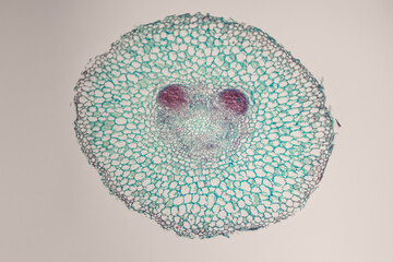Microscopic cross-section of plant stem tissue stained in green and red, showing vascular bundles and cellular structure.