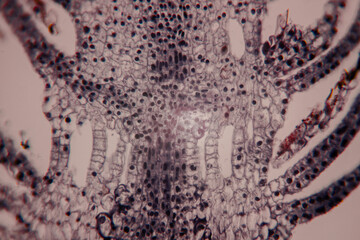 Microscopic view of plant tissue showing densely packed cells and vascular structures, stained in purple and black.