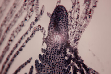 Microscopic view of plant tissue showing densely packed cells and vascular structures, stained in purple and black.