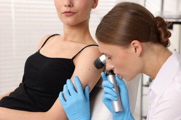 Doctor examining young woman's mole with dermatoscope in hospital