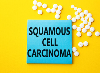 Squamous Cell Carcinoma symbol. Concept words Squamous Cell Carcinoma on blue note. Beautiful...