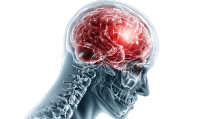 X-ray stylized brain image, highlighting an area of intense activity or injury