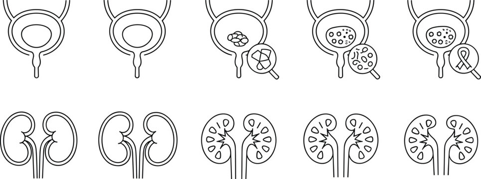 Human kidney and bladder icons, medical illustration, urinary system disease, kidney stone, bladder cancer awareness, nephrology, urology healthcare, flat vector illustration