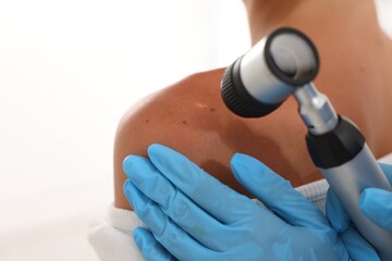 Doctor examining young woman's mole with dermatoscope on white background, closeup