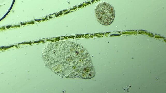 Microbe Stentor  under microscope at 100x magnification