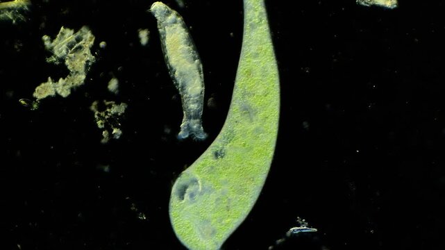 Stentor  under microscope at 100x magnification