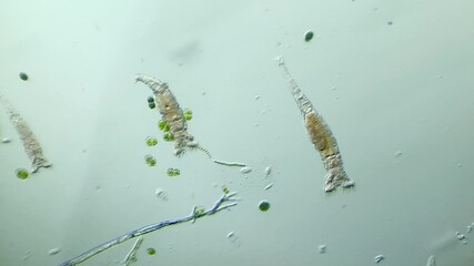 Rotifer under Optical Microscope at 100x Magnification