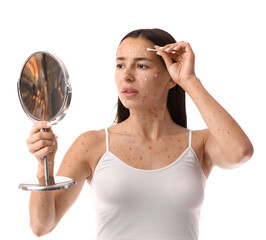 Young woman ill with chickenpox and mirror smearing spots on white background