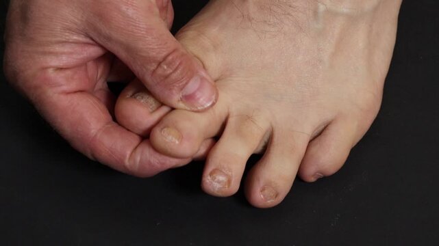 A man checks his toes by touching them with his hands, caring for his toenails.