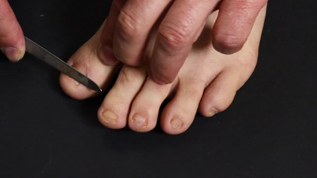 A man files his toenails with a nail file, pedicure close-up.