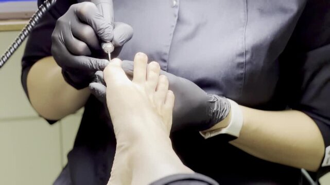 Close-up video of a podiatrist performing a medical pedicure. A specialist in black gloves uses professional tools to treat a patient's foot