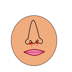 nose bleeding infection ijnury accident epistaxis blood from nose illustration medical .eps