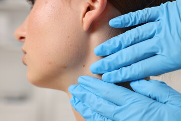 Doctor examining young woman's mole in hospital, closeup