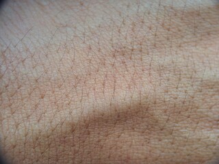 close-up view of human skin with fine hair and visible pores, highlighting the natural texture and...