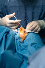 Eyelid surgery in the operating room. Plastic surgery operation, modifying the eye region in...