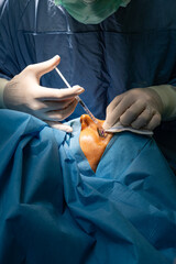 Eyelid surgery in the operating room. Plastic surgery operation, modifying the eye region in...