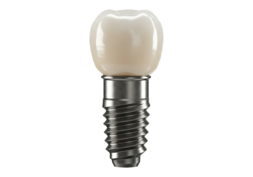 Dental implant with crown isolated on transparent background